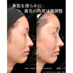 Zetith Beauty Clinic 銀座院 小川 悟史医師の症例