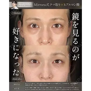 Mirrora CLINIC 田仲 祐貴医師の症例
