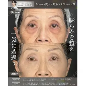 Mirrora CLINIC 田仲 祐貴医師の症例