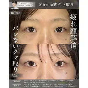 Mirrora CLINIC 田仲 祐貴医師の症例