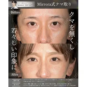 Mirrora CLINIC 田仲 祐貴医師の症例