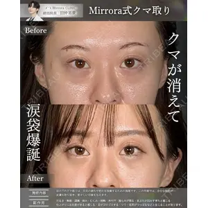 Mirrora CLINIC 田仲 祐貴医師の症例