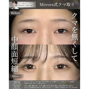 Mirrora CLINIC 田仲 祐貴医師の症例
