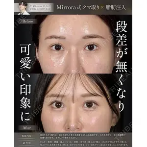 Mirrora CLINIC 田仲 祐貴医師の症例