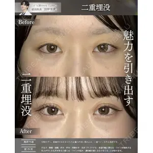 Mirrora CLINIC 田仲 祐貴医師の症例