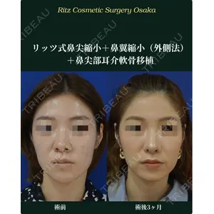 リッツ美容外科 大阪院 志賀　由章医師の症例
