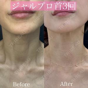 ルラ美容クリニック 渋谷本院 昼間 路子医師の症例
