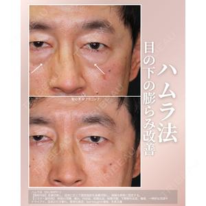 聖心美容クリニック 福岡院 權藤 理絵医師の症例