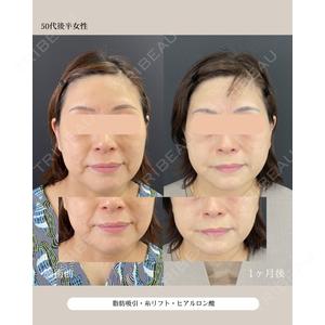 自由が丘ウェルエイジングビューティークリニック 福田 知佐子医師の症例