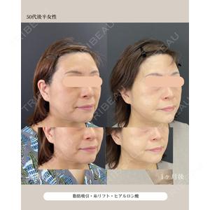 自由が丘ウェルエイジングビューティークリニックの症例