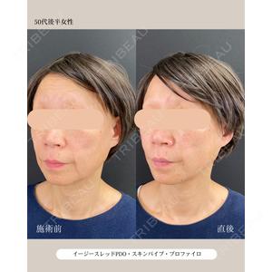 自由が丘ウェルエイジングビューティークリニック 福田 知佐子医師の症例