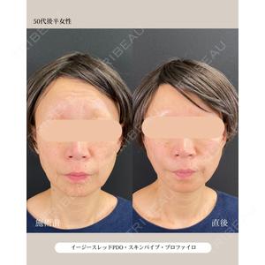 自由が丘ウェルエイジングビューティークリニック 福田 知佐子医師の症例