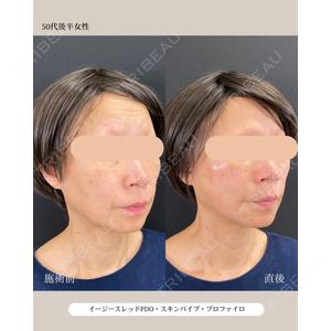 自由が丘ウェルエイジングビューティークリニック 福田 知佐子医師の症例
