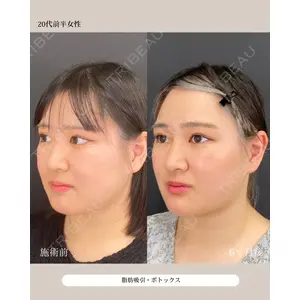 自由が丘ウェルエイジングビューティークリニック 福田 知佐子医師の症例