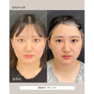 自由が丘ウェルエイジングビューティークリニック 福田 知佐子医師の症例