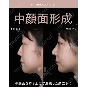 コントアクリニック 東京 石川 菜緒医師の症例
