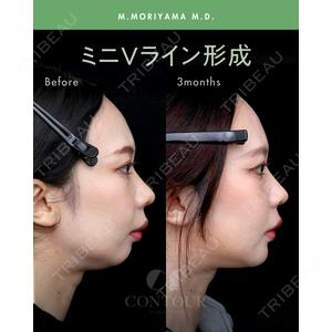 コントアクリニック 東京 森山 柾純医師の症例