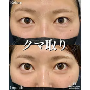 Brandnew Beauty Clinic 平山 容成医師の症例