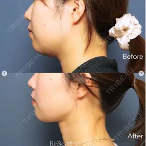 ReBeAS CLINICの症例