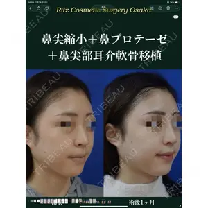 リッツ美容外科 大阪院 志賀　由章医師の症例