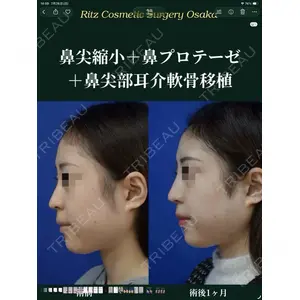 リッツ美容外科 大阪院 志賀　由章医師の症例