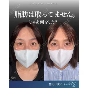 東京シンデレラ美容外科  横浜院 吉田 利之医師の症例