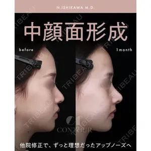 コントアクリニック 東京 石川 菜緒医師の症例