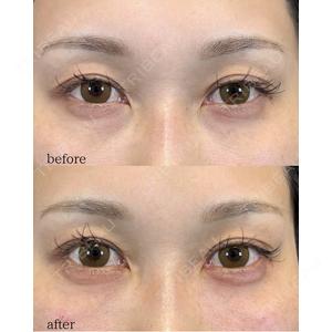 LA MER CLINIC 伊藤　整医師の症例
