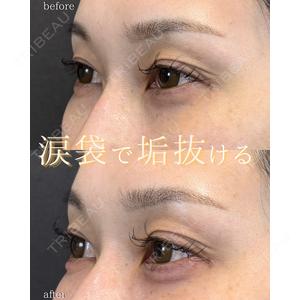 LA MER CLINIC 伊藤　整医師の症例