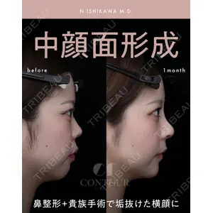 コントアクリニック 東京 石川 菜緒医師の症例