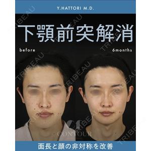 コントアクリニック 東京 服部 貴続医師の症例
