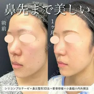 東京シンデレラ美容外科 池袋院 小出 真哉医師の症例