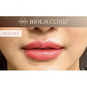 BiOLiS CLINICの症例