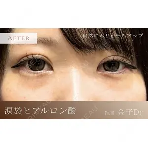 BiOLiS CLINICの症例