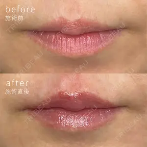 ミニマムスキンクリニック銀座の症例