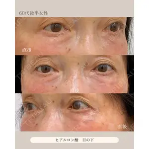 自由が丘ウェルエイジングビューティークリニック 福田 知佐子医師の症例