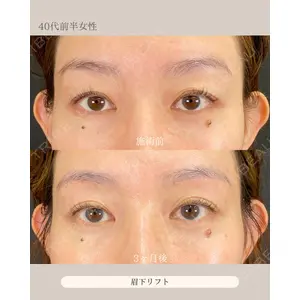 自由が丘ウェルエイジングビューティークリニック 福田 知佐子医師の症例