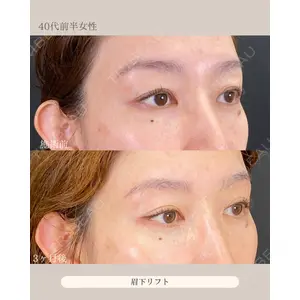 自由が丘ウェルエイジングビューティークリニック 福田 知佐子医師の症例