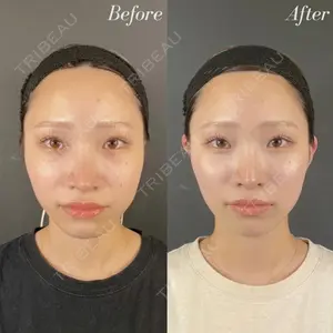 R Beauty CLINIC 名古屋院 木村 尚大医師の症例