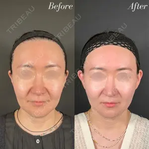 R Beauty CLINIC 名古屋院 木村 尚大医師の症例