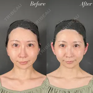 R Beauty CLINIC 名古屋院 木村 尚大医師の症例