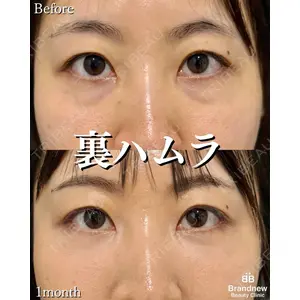 Brandnew Beauty Clinic 平山 容成医師の症例