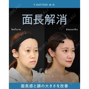 コントアクリニック 東京 服部 貴続医師の症例