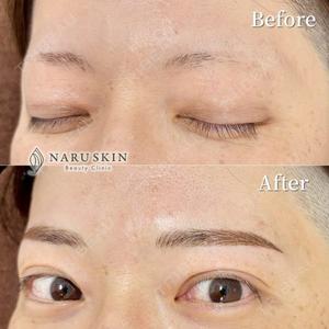 NARU Beauty Clinic 【ナルクリ】の症例