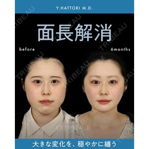 コントアクリニック 東京 服部 貴続医師の症例