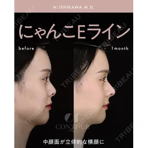 コントアクリニック 東京 石川 菜緒医師の症例
