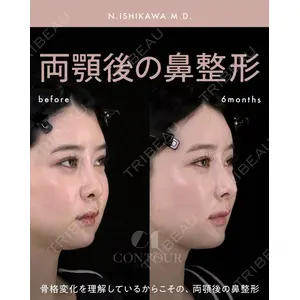 コントアクリニック 東京 石川 菜緒医師の症例