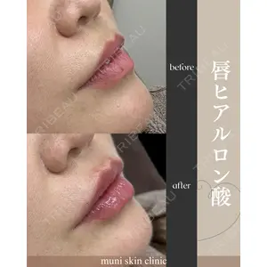 muni skin clinic 高麗 惠理医師の症例