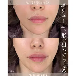 muni skin clinic 高麗 惠理医師の症例