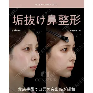 コントアクリニック 東京 石川 菜緒医師の症例